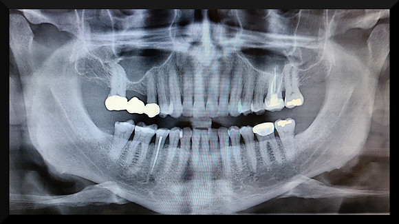 teeth